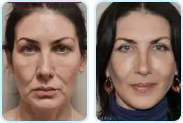 s12_review_1.png?as=webp&quality=50